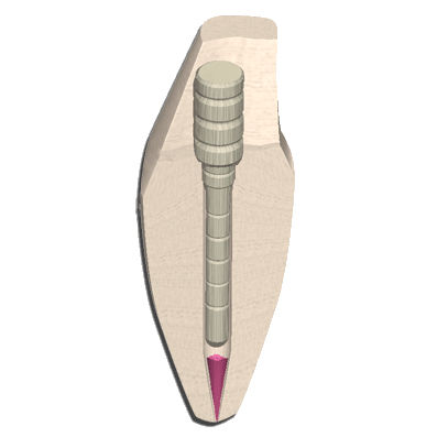 Perno radicolare in fibra - EZ-Fit&reg; Fiber - ESSENTIAL DENTAL SYSTEMS  