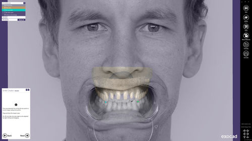 Software di analisi - Smile Creator - exocad GmbH   - di pianificazione / di progettazione / CAD