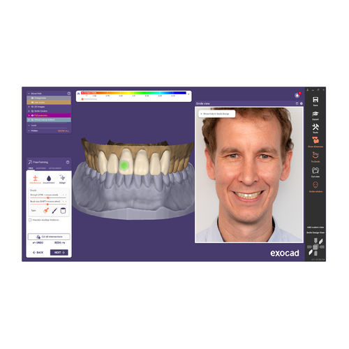 Software medico - ChairsideCAD - exocad GmbH   - clinico / per laboratorio dentale / per ricostruzione dentale