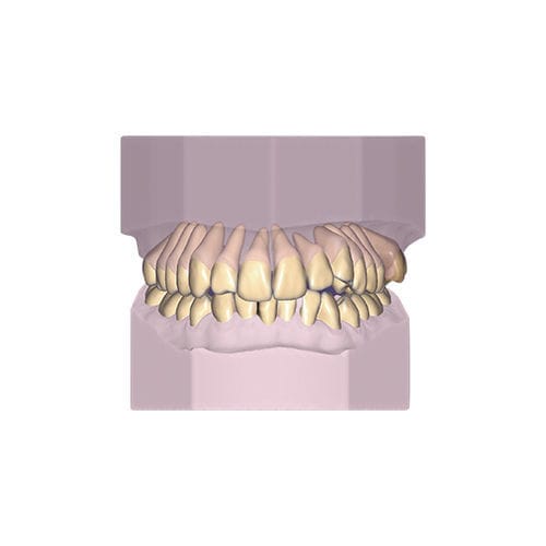 Modulo software di progettazione - Ortho - exocad GmbH   - di modelizzazione / di archiviazione / ortodontico