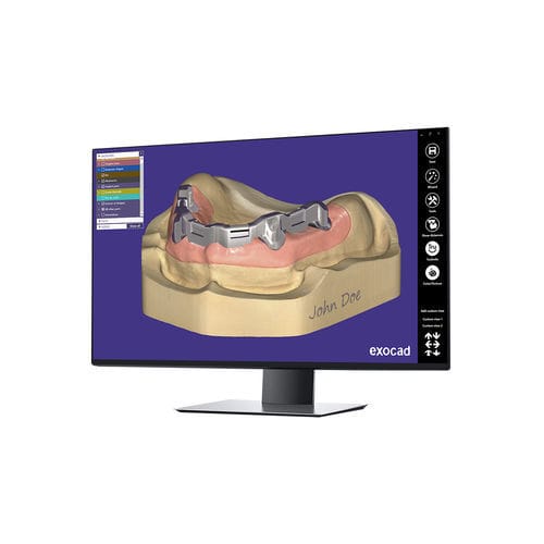 Modulo software clinico - Bar - exocad GmbH   - odontoiatrico / di misura / di progettazione