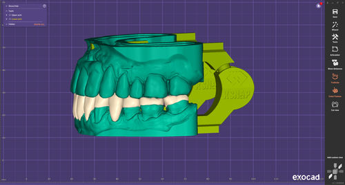 Modulo software CAD - xSNAP - exocad GmbH   - di masterizzazione / odontoiatrico / di articolazione