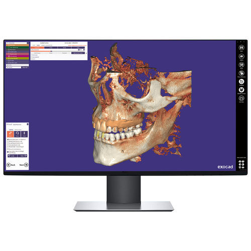 Modulo software medico - DICPDCAD - exocad GmbH   - odontoiatrico / per tomografia computerizzata / per radiografia