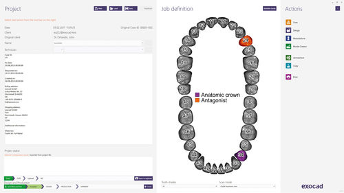 Software per ricostruzione dentale - dentalshare - exocad GmbH   - di gestione / di progettazione / CAD