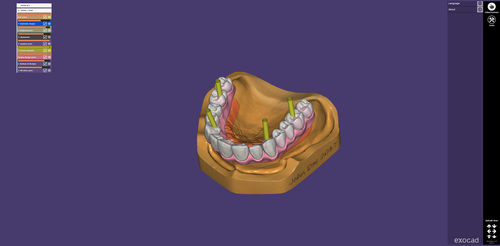 Applicazione web di condivisione - webview - exocad GmbH   - di visualizzazione 3D / medica / odontoiatrica