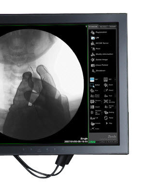 Software di acquisizione - ZENIS - Genoray - di gestione / per diagnostica per immagini