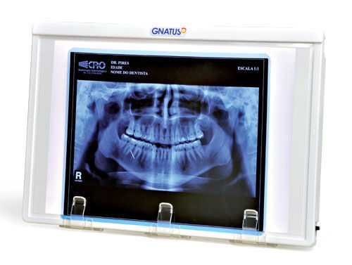 Negativoscopio 1 corpo - Gnatus - con interruttore / odontoiatrico / a luce bianca