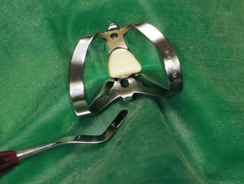 Uncino per diga dentale - 355335 - Hager & Werken