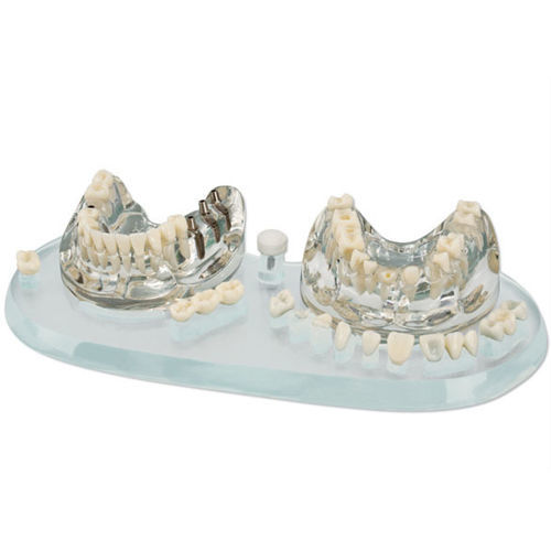 Modello anatomico di dentatura - 355638 - Hager & Werken - per implantologia / di dimostrazione