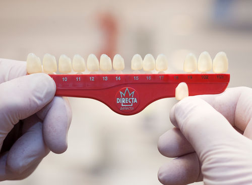 Corona dentale policarbonato - Directa - DIRECTA AB   - molari / traslucido