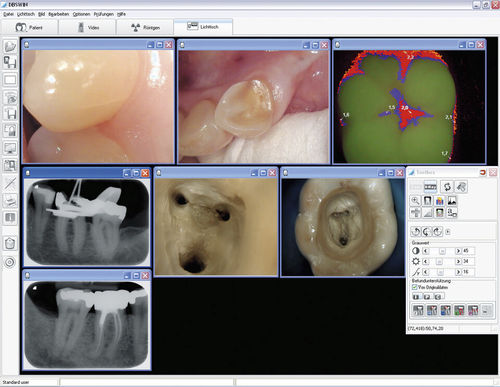Software di visualizzazione - DBSWIN  - Dürr Dental - diagnostico / di pianificazione / di progettazione