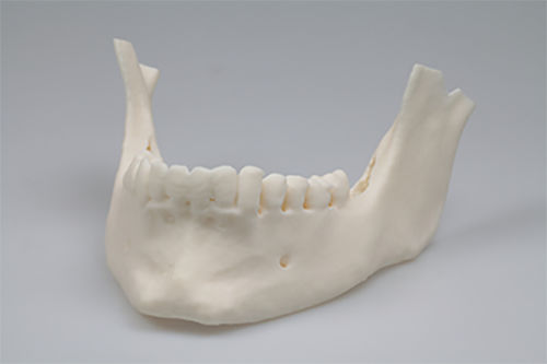 Materiale odontoiatrico in resina - Invicta 915 - DWS Systems - per stampa 3D / di modelizzazione / liquido