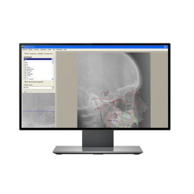 Software per imaging odontoiatrico - DFO - IMAGELEVEL - per imaging ortopedico / di analisi cefalometrica / per tablet PC