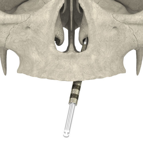 Punta per implantologia dentale - JDNasal TranZ  - JDENTALCARE SRL   - in gesso / in diamante