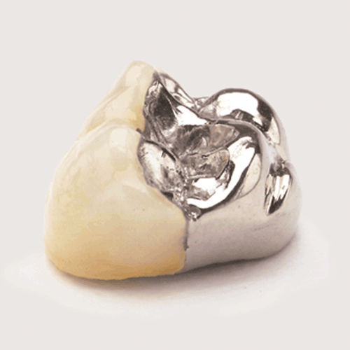 Materiale odontoiatrico in porcellana - JPW - Jensen Dental   - per ricostruzione dentale / per ponti dentali / solido