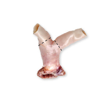 Bioprotesi vascolare arteria polmonare - CardioGraft® - Lifenet Health   - allotrapianto
