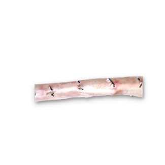 Bioprotesi vascolare di aorta toracica - CardioGraft® - Lifenet Health   - allotrapianto