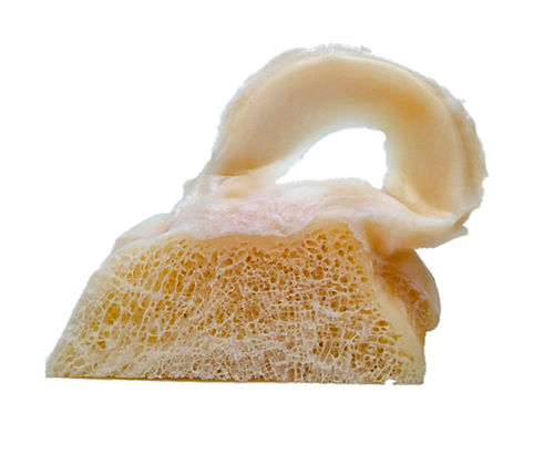 Protesi meniscale allotrapianto - FlexiGRAFT®  - Lifenet Health  