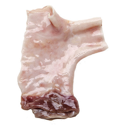 Bioprotesi vascolare arteria polmonare - CardioGraft ® - Lifenet Health   - allotrapianto