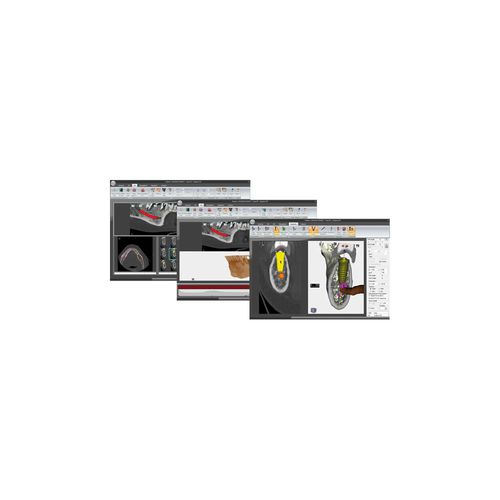 Software per implantologia dentale - S3D - MARIOTTI & C - di simulazione 3D / osseo / mandibolare