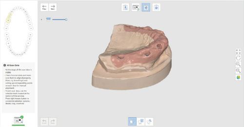 Software di acquisizione - Medit   - di acquisizione / per laboratorio dentale / per implantologia dentale