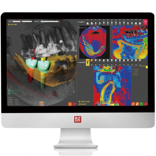 Software di pianificazione - R2GATE - Megagen Implant - di simulazione d'impianto dentale / FAO / di progettazione di protesi dentale