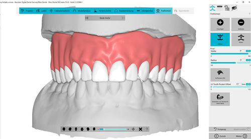 Software di analisi - BDCreator® PLUS - Merz Dental GmbH   - di progettazione / d’importazione / di masterizzazione