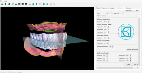 Software di analisi - BDCreator® - Merz Dental GmbH   - di controllo / di visualizzazione / di progettazione di protesi dentale