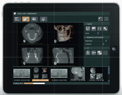 Software diagnostico - i-Dixel Web - Morita - di visualizzazione / di gestione dati / per imaging odontoiatrico