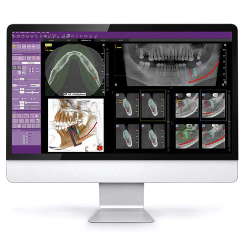 Software di analisi delle immagini - iRYS - MyRay - visualizzatore / diagnostico / di pianificazione