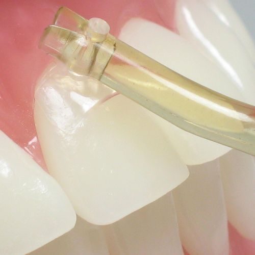 Materiale odontoiatrico in PMMA - NA056 - Navadha Enterprises   - per ricostruzione dentale / trasparente