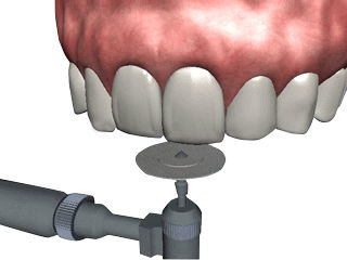 Software per chirurgia odontoiatrica - NA501  - Navadha Enterprises   - di trattamento / didattico / parodontale