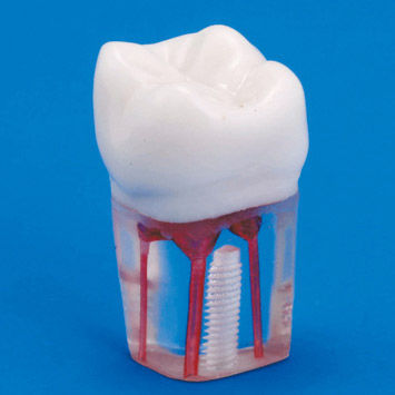Modello anatomico di denti - S12A-200 - Nissin Dental Products Inc.   - di canale radicolare / didattico / trasparente