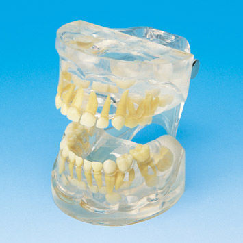 Modello anatomico di dentatura - PE-PDI001 - Nissin Dental Products Inc.   - ad uso didattico / di bambino / trasparente
