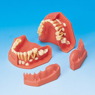 Modello anatomico di dentatura - PE-PDI004 - Nissin Dental Products Inc.   - gengivale / ad uso didattico / di bambino