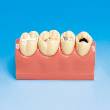 Modello anatomico odontoiatrico - PE-STP007 - Nissin Dental Products Inc.   - ad uso didattico / di carie