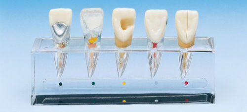 Modello anatomico odontoiatrico - PE-END001 - Nissin Dental Products Inc.   - di canale radicolare / per endodonzia / ad uso didattico