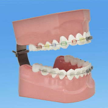 Modello anatomico di denti - PE-ORT002 - Nissin Dental Products Inc.   - per igiene dentale / per ortodonzia / ad uso didattico