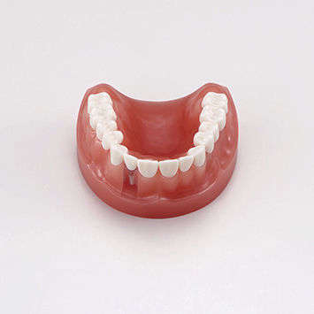 Modello anatomico di mandibola - PE-PRO020 - Nissin Dental Products Inc.   - di dentatura / gengivale / per protesistica dentale