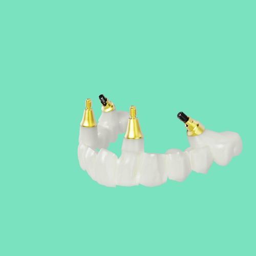 Ponte dentale in titanio - NobelProcera® - Nobel Biocare Services AG   - in zircone / per denti anteriori / per denti posteriori