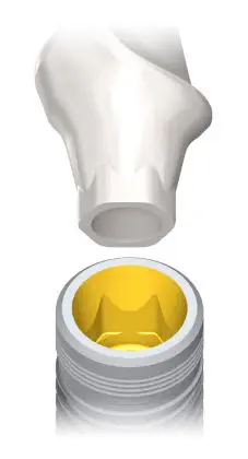 Straight Loc-In Conical - DSI Dental Solutions