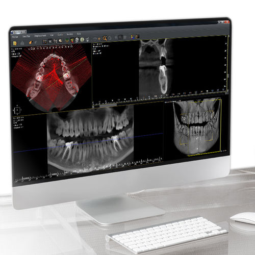 software per imaging odontoiatrico - Owandy Radiology