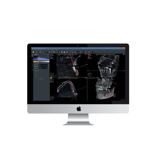 Software medico - Owandy Radiology - per imaging odontoiatrico / per DICOM / per implantologia dentale