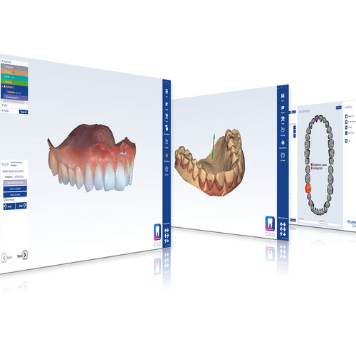Software CAD - PlanCAD® Premium - Planmeca - di progettazione di protesi dentale / d’importazione / FAO