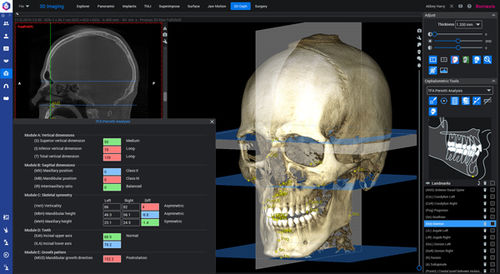 Modulo software per ortodonzia - Romexis® 3D - Planmeca - per chirurgia maxillo-facciale / odontoiatrico / per imaging odontoiatrico