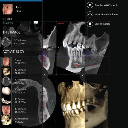 Applicazione iOS di visualizzazione - mRomexis™ - Planmeca - di acquisizione / clinica / odontoiatrica