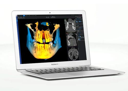 Applicazione web visualizzatore - Romexis®  - Planmeca - medica / odontoiatrica / odontoiatrica