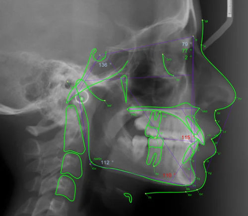 Modulo software per chirurgia maxillo-facciale - Romexis® - Planmeca - ortodontico / odontoiatrico / di analisi delle immagini