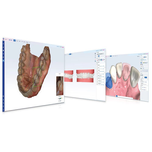 Modulo software odontoiatrico - Romexis® CAD/CAM - Planmeca - per imaging odontoiatrico / per ortodonzia / per laboratorio dentale
