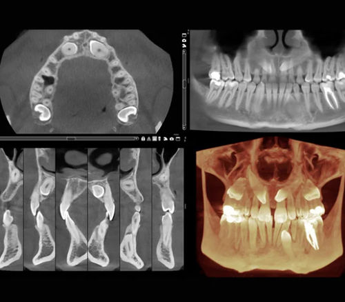 Software medico - Romexis® 3D - Planmeca - per chirurgia / odontoiatrico / per endodonzia